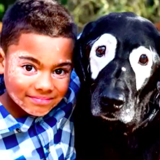 Un niño con vitiligo recupera la sonrisa y pierde la …