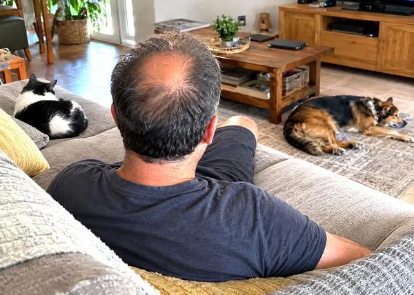 Los medicamentos con minoxidil para la caída del cabello son extremadamente peligrosos para perros y, sobre todo, para gatos