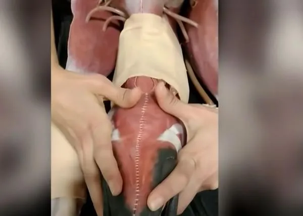 La Técnica de Extracción Externa: muy útil para salvar a un perro que se ha atragantado y está inconsciente