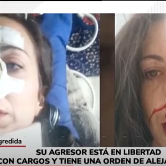 Una mujer recibe una brutal paliza por recriminar a un …