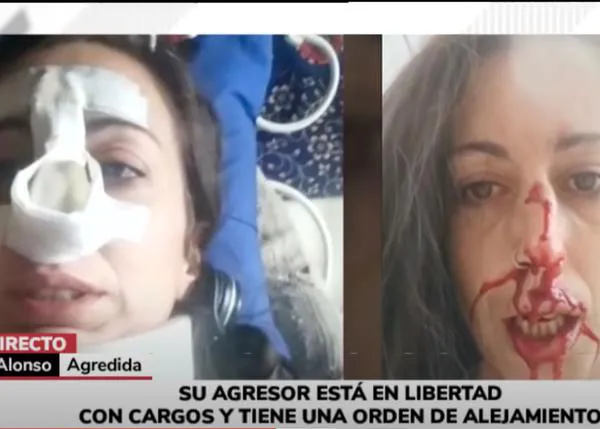 Una mujer recibe una brutal paliza por recriminar a un hombre que pegaba a su perro en Vigo